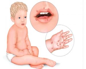 6bc5154bd73bab84ef67892390066075