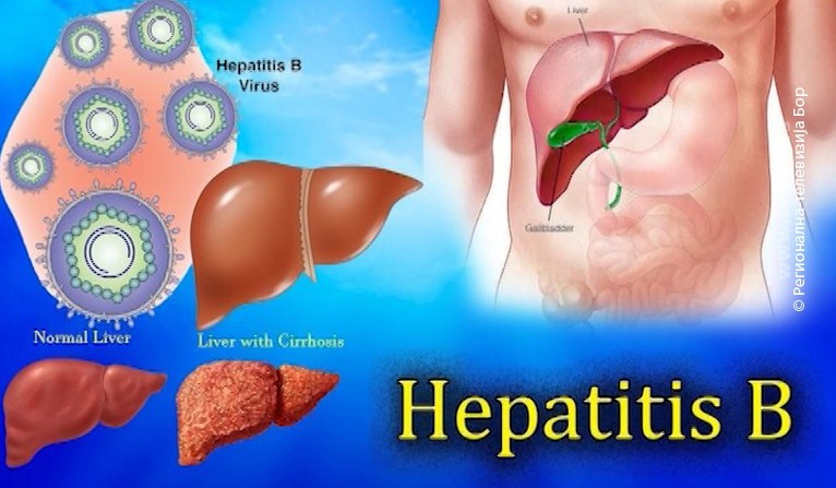 28072020_Hepatitis
